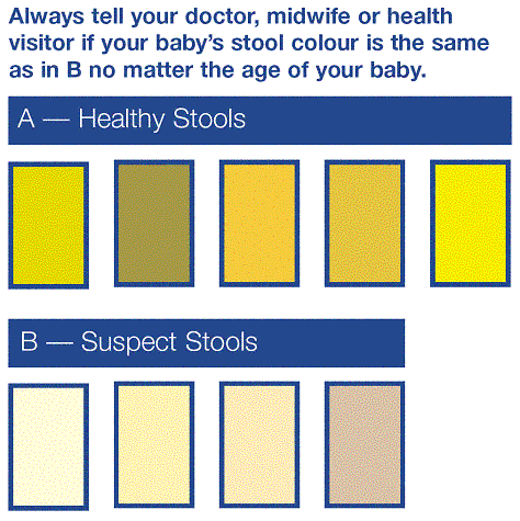 Chart showing healthy and unhealthy stool colours.