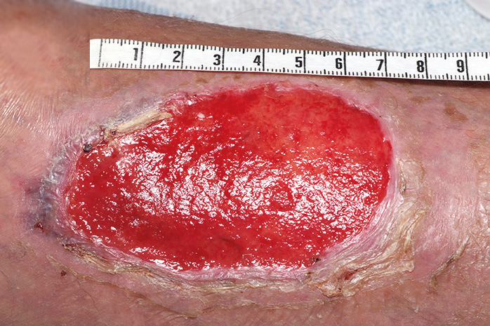 Continuing management