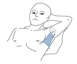 Triangle of safety diagram