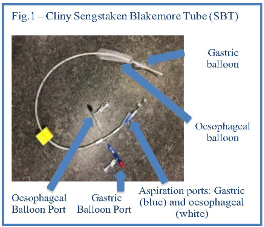 Figure 1 -  Photo of a Cliny Sengstaken Blakemore Tube